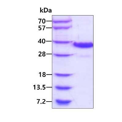 SDS-PAGE: Recombinant Human RACK1/GNB2L1 His Protein [NBP1-78874]